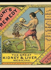 %d0%9e%d0%b1%d0%bb%d0%be%d0%b6%d0%ba%d0%b0